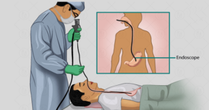 Endoscopy in Shalimar Garden