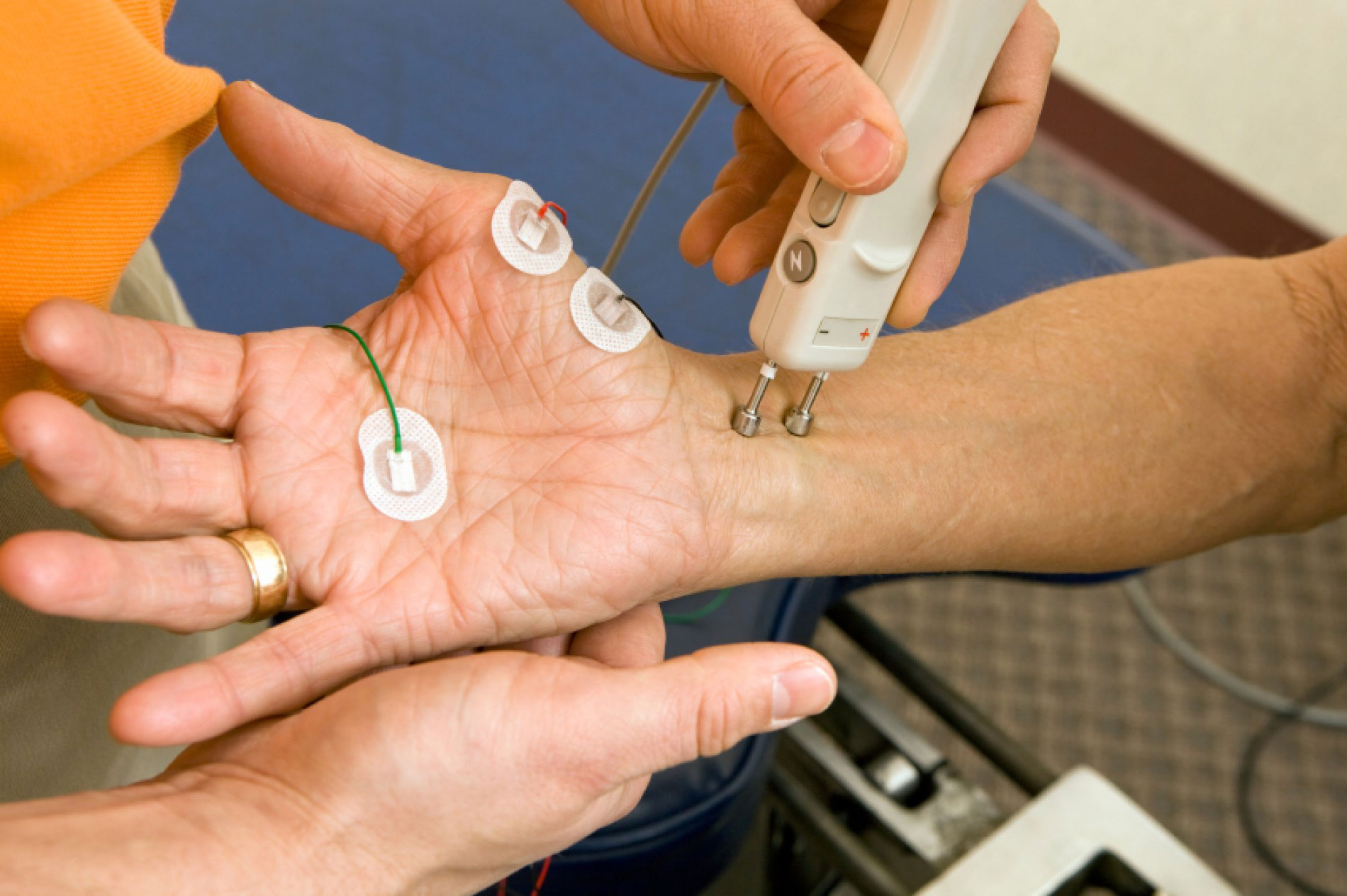 The Basics of Electromyography and Its Clinical Uses